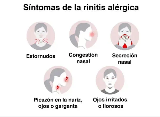 Síntomas de la rinitis alérgica. Crédito: BBC.COM 