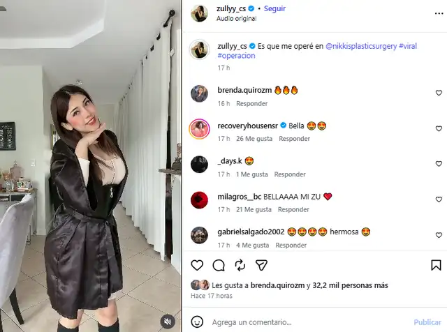 Zully se luce después de su cirugía estétitca.