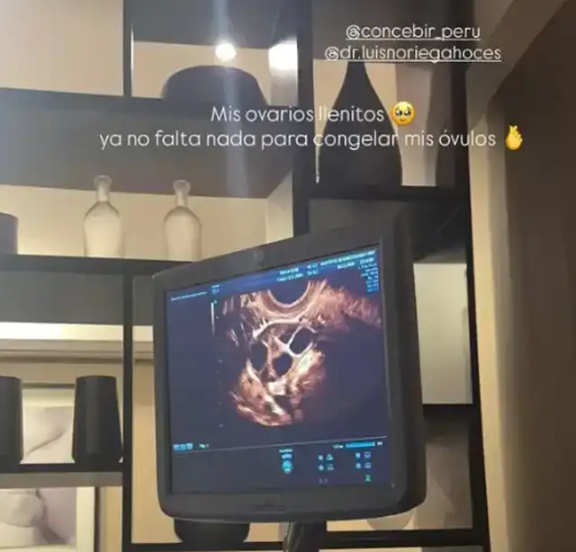 Gianella Marquina reveló que congelará sus óvulos.  