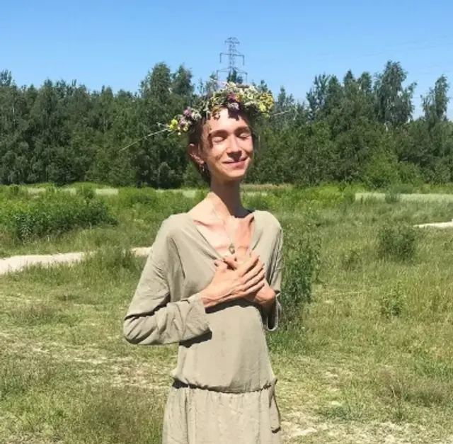  Querida influencer fallece por desnutrición y llegó a pesar 22 kilos 