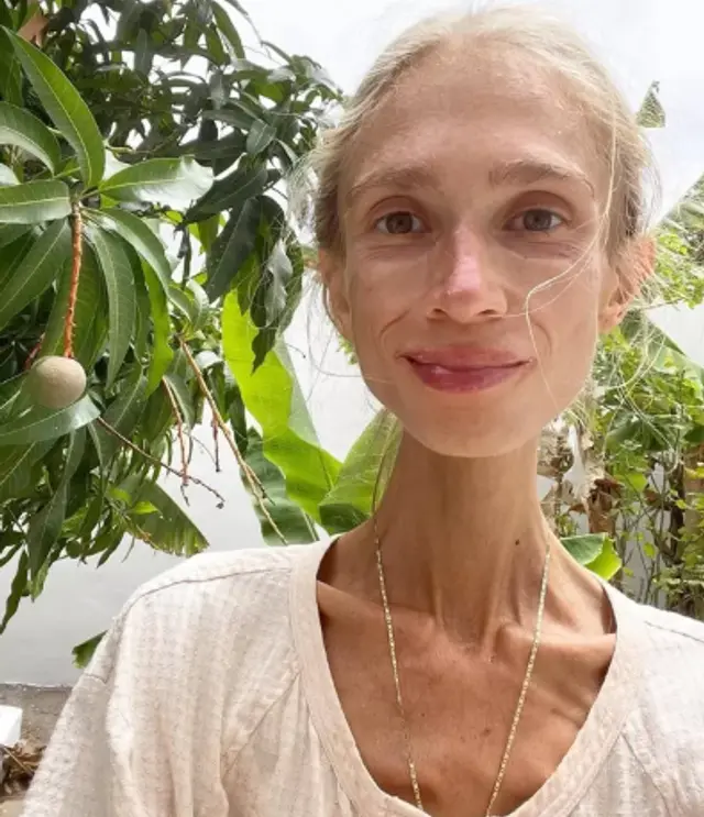     Influência favorita morre de desnutrição e massa 22 kg 