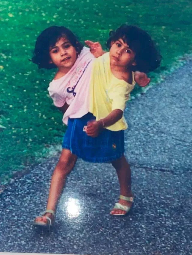  Las siamesas Lupita y Carmen cuando eran menores de edad.    