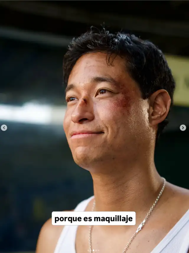Tony Succar preocupa al aparecer con moretones en todo el rostro y revela su estado