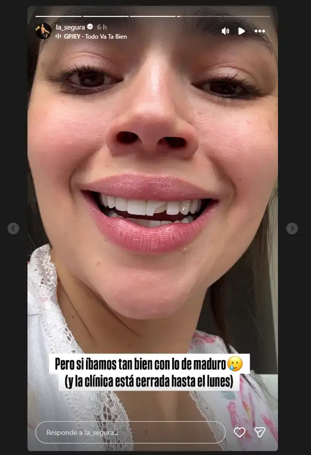Natalia Segura preocupa tras anunciar que parte de su carilla dental se rompió. Foto: Instagram.   