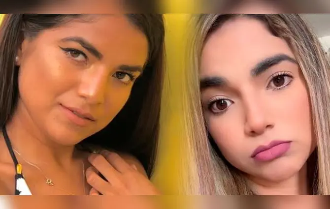 Susana Alvarado CONFIRMA que se someterá a una cirugía en la nariz: “¿Ustedes me entienden, no?"