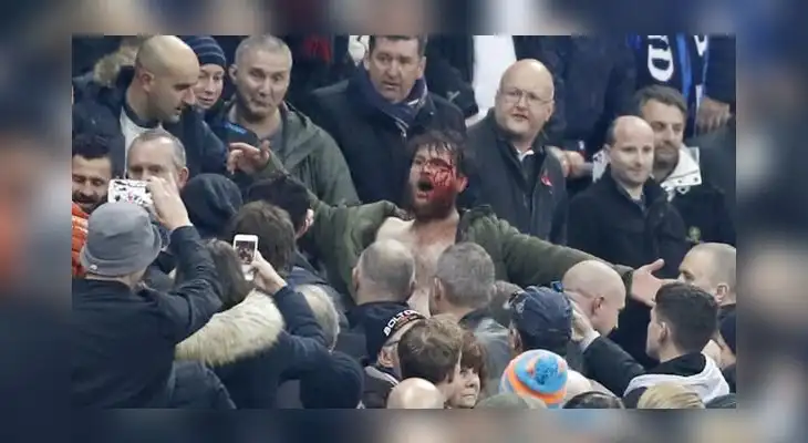Este hincha fue brutalmente agredido Este hincha fue brutalmente agredido