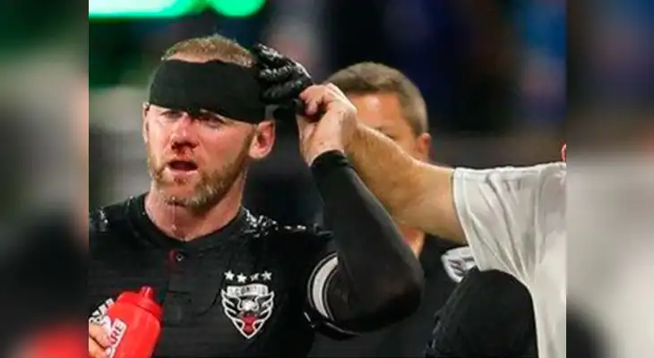 Wayne Rooney terminó con la nariz rota luego de recibir brutal codazo en la MLS Wayne Rooney terminó con la nariz rota luego de recibir brutal codazo en la MLS