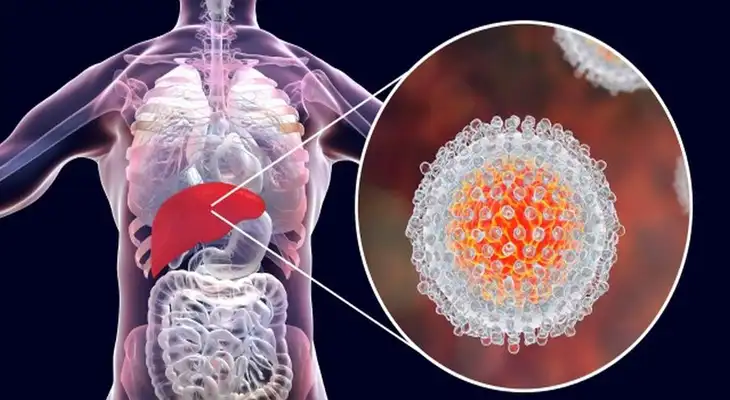 La hepatitis vírica. La hepatitis vírica.