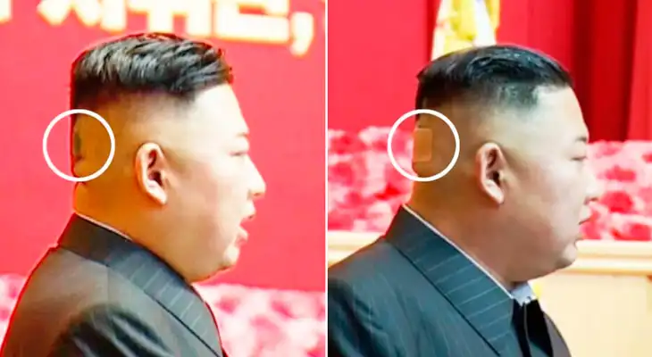 El líder norcoreano, Kim Jong-Un, tiene una extraña mancha verde oscuro en la parte posterior de la cabeza. El líder norcoreano, Kim Jong-Un, tiene una extraña mancha verde oscuro en la parte posterior de la cabeza.