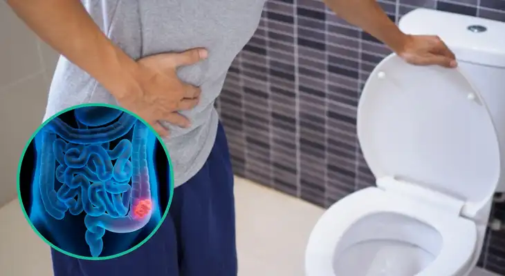 Un signo pueden ser cambios en los hábitos intestinales como el estreñimiento. Un signo pueden ser cambios en los hábitos intestinales como el estreñimiento.