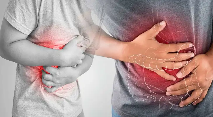 Conoce cómo diferenciar hemorroides de un cáncer al colon Conoce cómo diferenciar hemorroides de un cáncer al colon