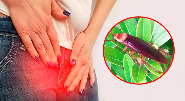 Médicos revelaron que encontraron un insecto en las partes íntimas de la mujer.