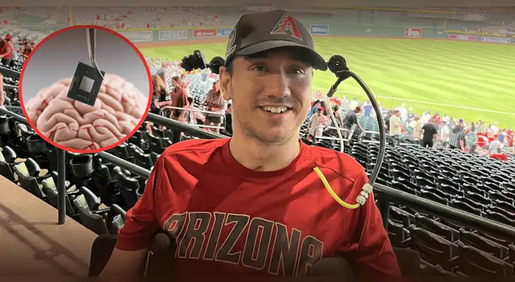 Problemas técnicos afectan al primer humano con chip cerebral de Musk.